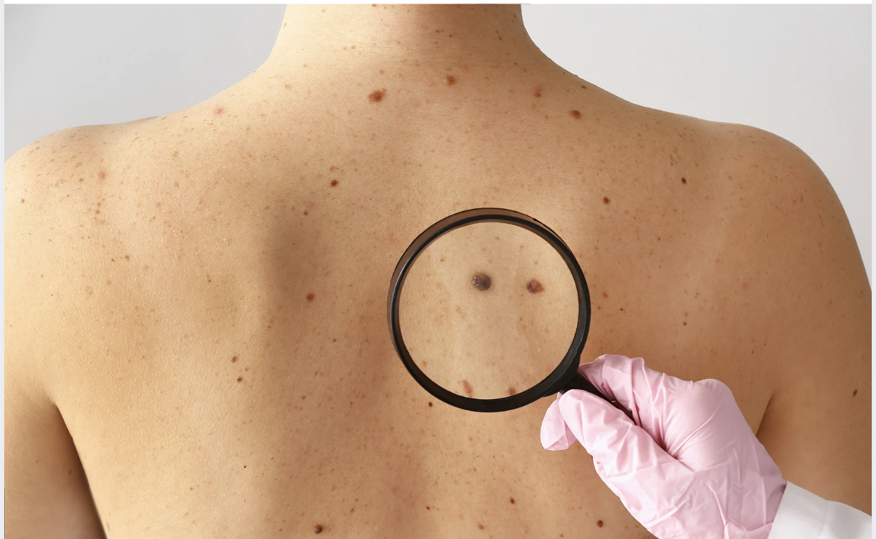 5 Skin Changes You Should Never Ignore