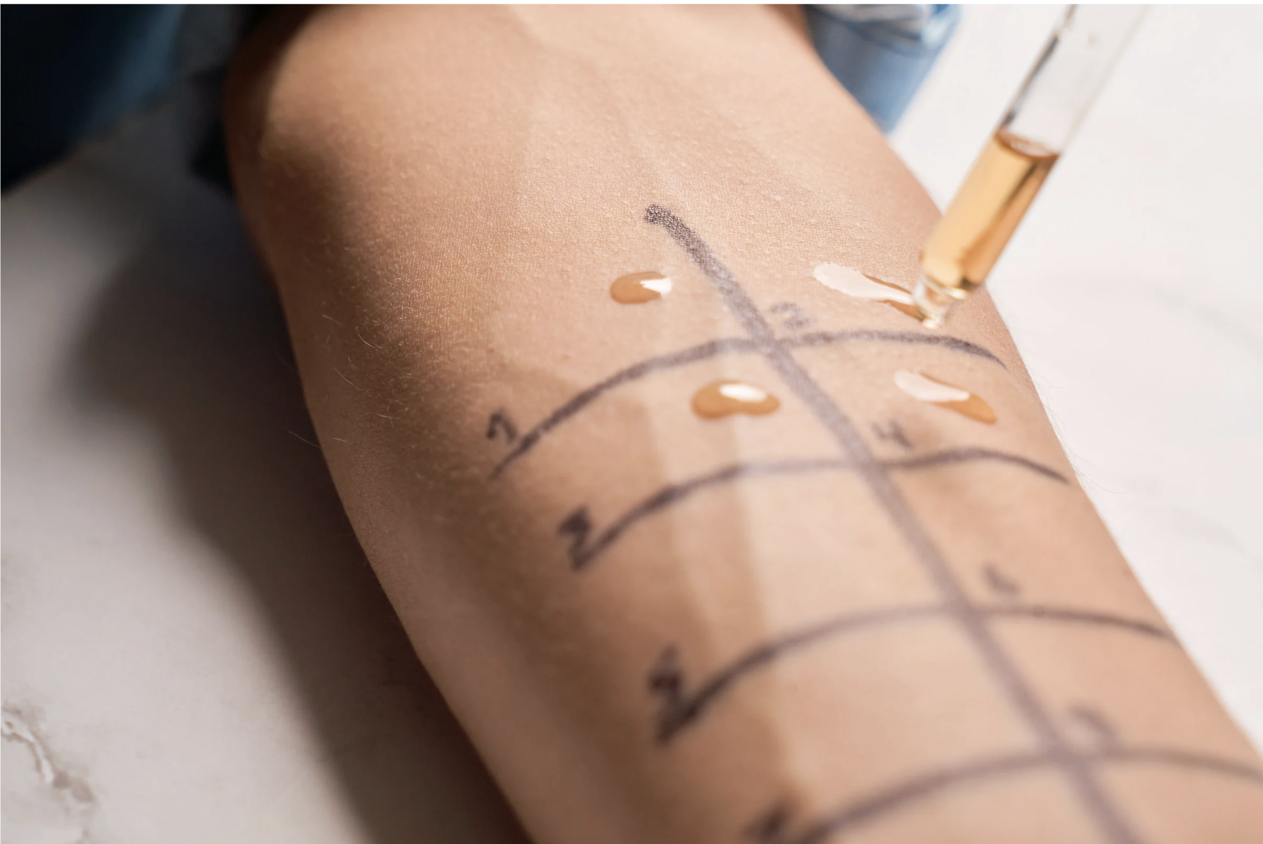 Allergy Testing