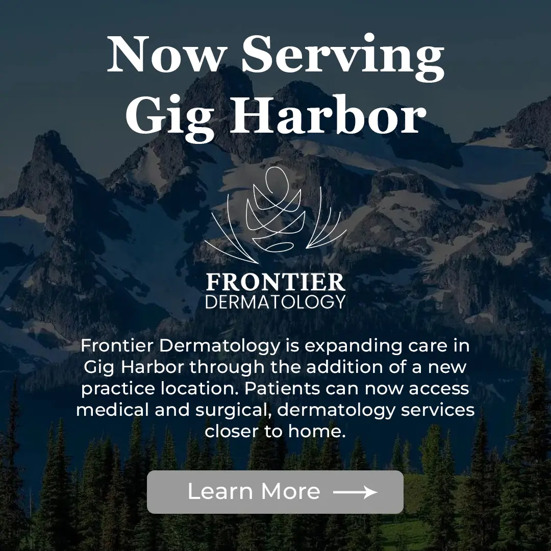 Now Serving Gig Harbor