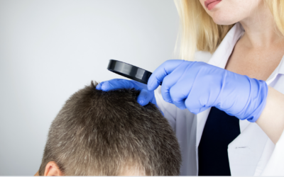 Hair Loss Awareness Month: Why Early Answers Make All the Difference