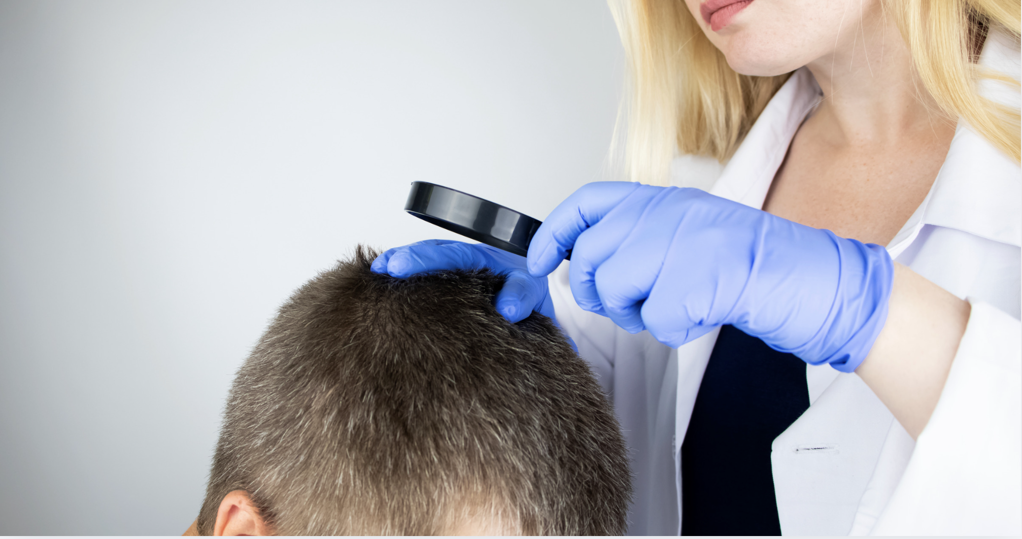 Hair Loss Awareness Month: Why Early Answers Make All the Difference