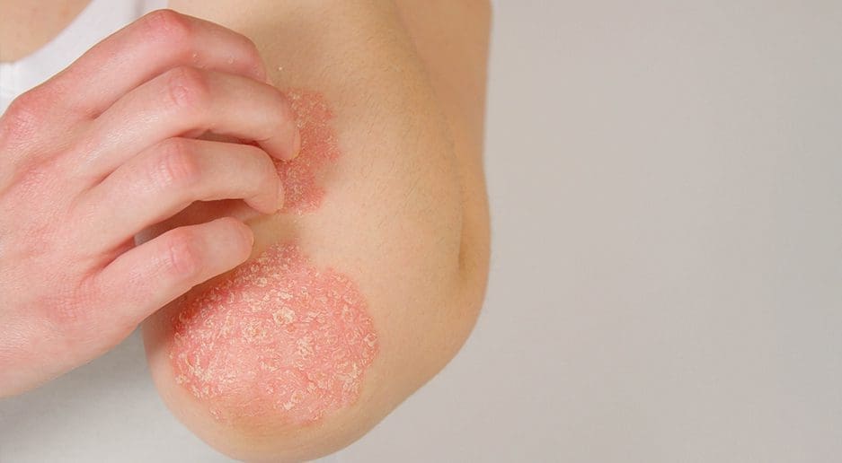 Medical Dermatology