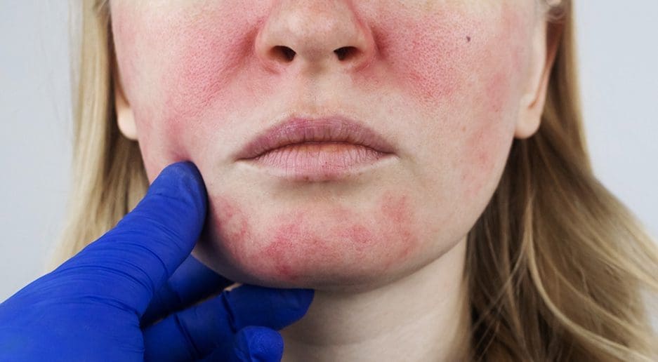 Medical Dermatology