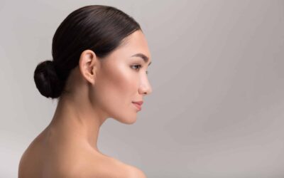 What Areas Can be Treated with Chemical Peels?